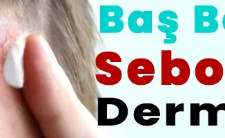 seboreik dermatit